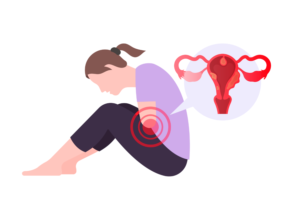 In article image_Endometriosis blog.png